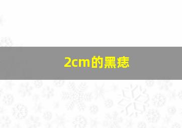 2cm的黑痣