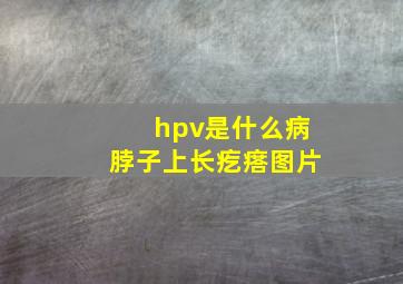 hpv是什么病脖子上长疙瘩图片