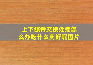 上下颌骨交接处疼怎么办吃什么药好呢图片