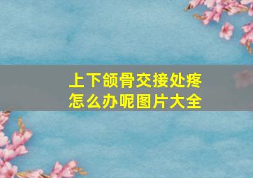 上下颌骨交接处疼怎么办呢图片大全