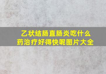 乙状结肠直肠炎吃什么药治疗好得快呢图片大全