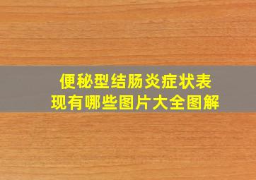 便秘型结肠炎症状表现有哪些图片大全图解