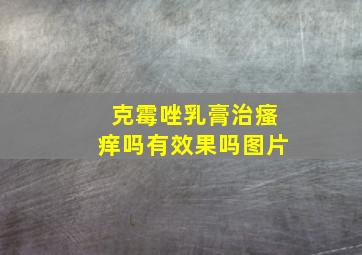 克霉唑乳膏治瘙痒吗有效果吗图片