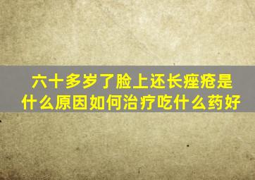 六十多岁了脸上还长痤疮是什么原因如何治疗吃什么药好