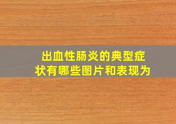 出血性肠炎的典型症状有哪些图片和表现为