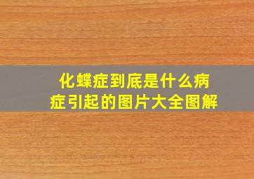 化蝶症到底是什么病症引起的图片大全图解