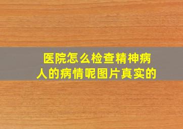 医院怎么检查精神病人的病情呢图片真实的