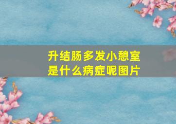 升结肠多发小憩室是什么病症呢图片