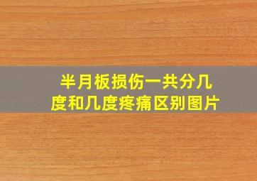 半月板损伤一共分几度和几度疼痛区别图片