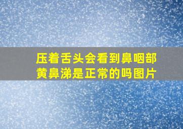 压着舌头会看到鼻咽部黄鼻涕是正常的吗图片