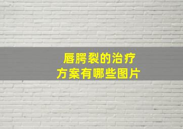 唇腭裂的治疗方案有哪些图片