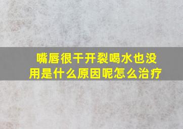 嘴唇很干开裂喝水也没用是什么原因呢怎么治疗