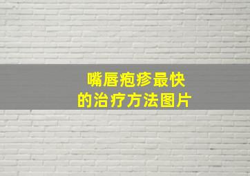 嘴唇疱疹最快的治疗方法图片