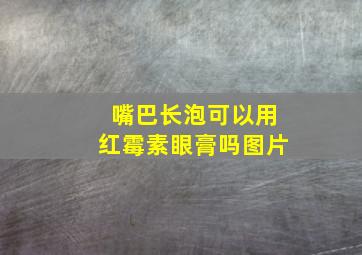 嘴巴长泡可以用红霉素眼膏吗图片