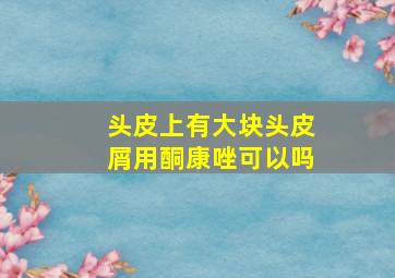 头皮上有大块头皮屑用酮康唑可以吗