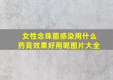 女性念珠菌感染用什么药膏效果好用呢图片大全