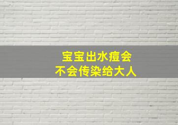 宝宝出水痘会不会传染给大人