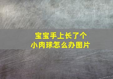 宝宝手上长了个小肉球怎么办图片