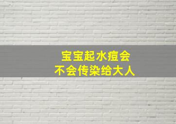 宝宝起水痘会不会传染给大人