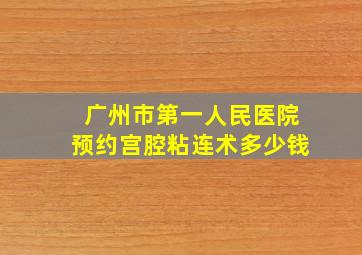 广州市第一人民医院预约宫腔粘连术多少钱