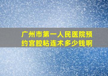 广州市第一人民医院预约宫腔粘连术多少钱啊