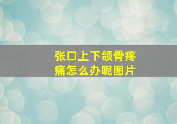 张口上下颌骨疼痛怎么办呢图片