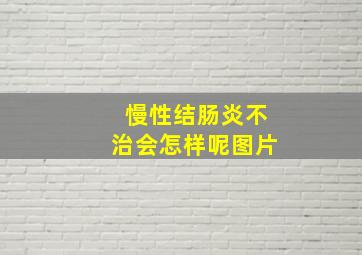 慢性结肠炎不治会怎样呢图片