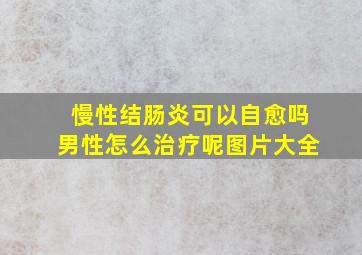 慢性结肠炎可以自愈吗男性怎么治疗呢图片大全