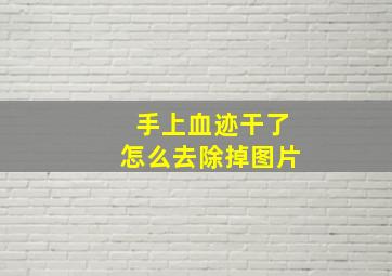 手上血迹干了怎么去除掉图片