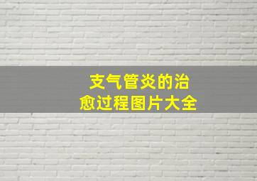 支气管炎的治愈过程图片大全