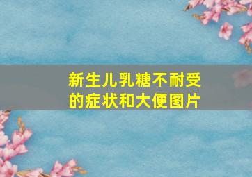 新生儿乳糖不耐受的症状和大便图片