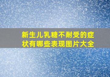 新生儿乳糖不耐受的症状有哪些表现图片大全