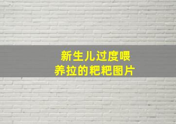 新生儿过度喂养拉的粑粑图片