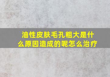 油性皮肤毛孔粗大是什么原因造成的呢怎么治疗