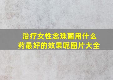 治疗女性念珠菌用什么药最好的效果呢图片大全