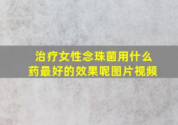 治疗女性念珠菌用什么药最好的效果呢图片视频