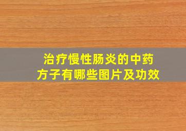 治疗慢性肠炎的中药方子有哪些图片及功效