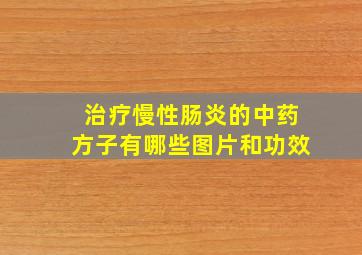 治疗慢性肠炎的中药方子有哪些图片和功效