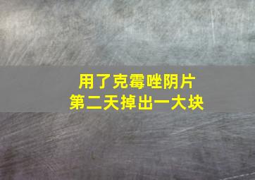 用了克霉唑阴片第二天掉出一大块