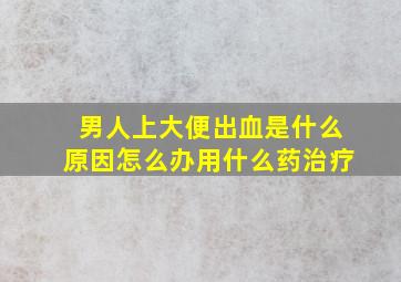 男人上大便出血是什么原因怎么办用什么药治疗