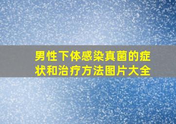 男性下体感染真菌的症状和治疗方法图片大全