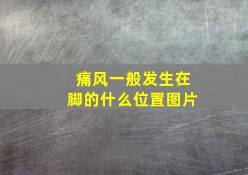 痛风一般发生在脚的什么位置图片