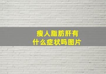 瘦人脂肪肝有什么症状吗图片