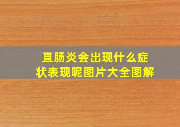 直肠炎会出现什么症状表现呢图片大全图解