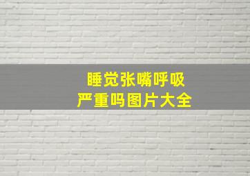 睡觉张嘴呼吸严重吗图片大全