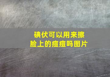 碘伏可以用来擦脸上的痘痘吗图片