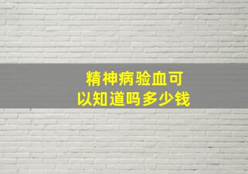 精神病验血可以知道吗多少钱