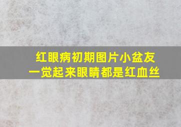 红眼病初期图片小盆友一觉起来眼睛都是红血丝