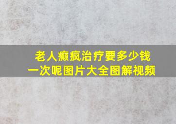 老人癫疯治疗要多少钱一次呢图片大全图解视频