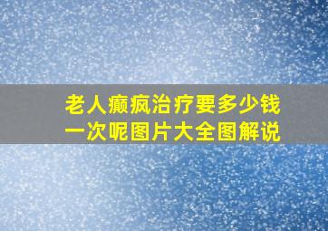 老人癫疯治疗要多少钱一次呢图片大全图解说